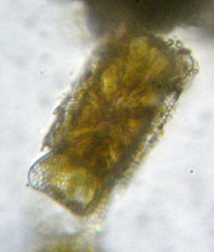 Diatomea marina: Odontella aurita var. obtusa (quasi sicuro)